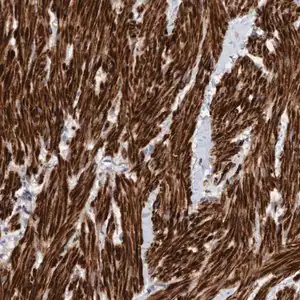 Merck Anti-LONRF1 antibody produced in rabbit