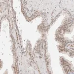 Merck Anti-ZNF613 antibody produced in rabbit