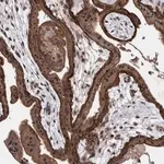 Merck Anti-PIK3R6 antibody produced in rabbit