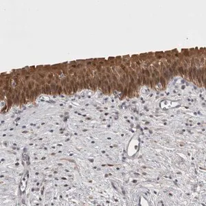 Merck Anti-CHIC2 antibody produced in rabbit