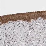 Merck Anti-CHIC2 antibody produced in rabbit