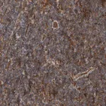 Merck Anti-BNIP2 antibody produced in rabbit