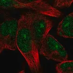 Merck Anti-TRIM72 antibody produced in rabbit