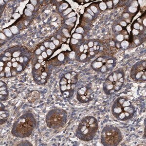 Merck Anti-DDHD2 antibody produced in rabbit