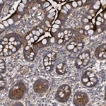 Merck Anti-DDHD2 antibody produced in rabbit