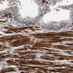 Merck Anti-GRPEL2 antibody produced in rabbit