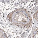 Merck Anti-EFEMP2 antibody produced in rabbit