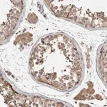 Merck Anti-PARP6 antibody produced in rabbit