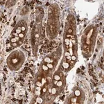 Merck Anti-UTS2B antibody produced in rabbit