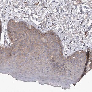 Merck Anti-SRD5A3 antibody produced in rabbit