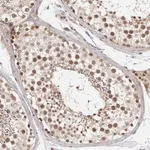 Merck Anti-ZNF318 antibody produced in rabbit