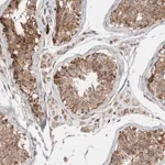 Merck Anti-C17orf53 antibody produced in rabbit