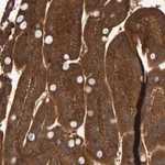 Merck Anti-CCDC57 antibody produced in rabbit
