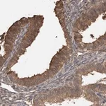Merck Anti-TRIM5 antibody produced in rabbit