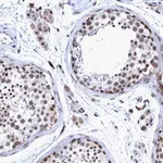 Merck Anti-GLT6D1 antibody produced in rabbit