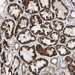 Merck Anti-TDRKH antibody produced in rabbit