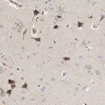 Merck Anti-AKAP13 antibody produced in rabbit