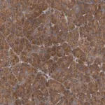 Merck Anti-UBAP1 antibody produced in rabbit