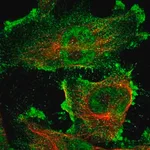 Merck Anti-ARHGAP23 antibody produced in rabbit