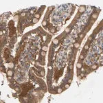 Merck Anti-TPMT antibody produced in rabbit