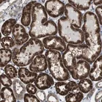 Merck Anti-CDC34 antibody produced in rabbit