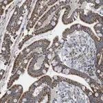 Merck Anti-CALHM2 antibody produced in rabbit