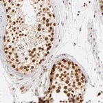 Merck Anti-ILKAP antibody produced in rabbit