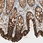 Merck Anti-SKIL antibody produced in rabbit