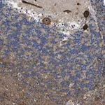 Merck Anti-KIAA1551 antibody produced in rabbit