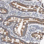 Merck Anti-GRPEL2 antibody produced in rabbit