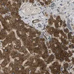Merck Anti-FUT11 antibody produced in rabbit