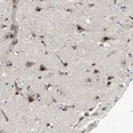 Merck Anti-PALD1 antibody produced in rabbit