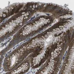 Merck Anti-GDF5 antibody produced in rabbit