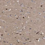 Merck Anti-SPAST antibody produced in rabbit