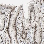 Merck Anti-C1orf174 antibody produced in rabbit