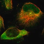 Merck Anti-TMEM132C antibody produced in rabbit