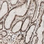 Merck Anti-BLM antibody produced in rabbit