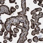 Merck Anti-LYSMD3 antibody produced in rabbit