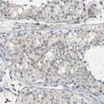 Merck Anti-PTGDS antibody produced in rabbit