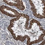 Merck Anti-B3GAT2 antibody produced in rabbit
