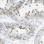 Merck Anti-PITHD1 antibody produced in rabbit