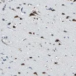 Merck Anti-ZNF415 antibody produced in rabbit