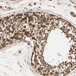 Merck Anti-RNF14 antibody produced in rabbit