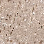 Merck Anti-HECW1 antibody produced in rabbit