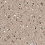 Merck Anti-HSPA13 antibody produced in rabbit