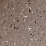 Merck Anti-CAMK4 antibody produced in rabbit