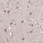 Merck Anti-HECTD1 antibody produced in rabbit