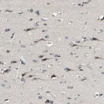 Merck Anti-PIP5K1B antibody produced in rabbit