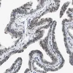 Merck Anti-HIPK1 antibody produced in rabbit