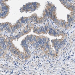 Merck Anti-CFAP20 antibody produced in rabbit